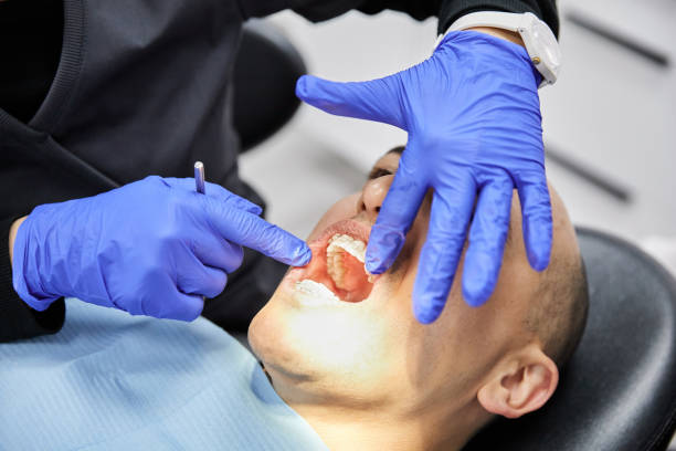 Best Emergency Tooth Extraction in Richfield, WI