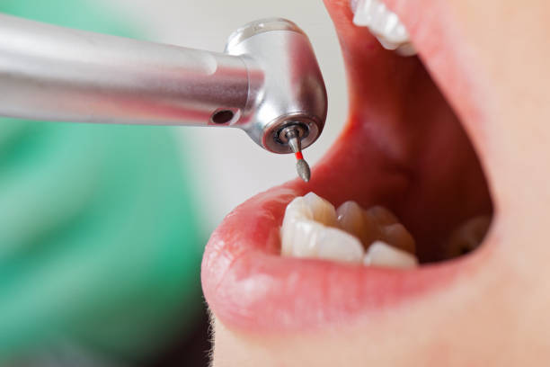 Best Walk-In Emergency Dentist in Richfield, WI